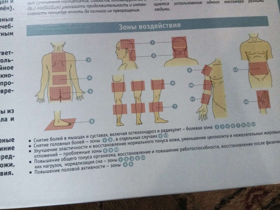 Зоны для аппликатора Кузнецова