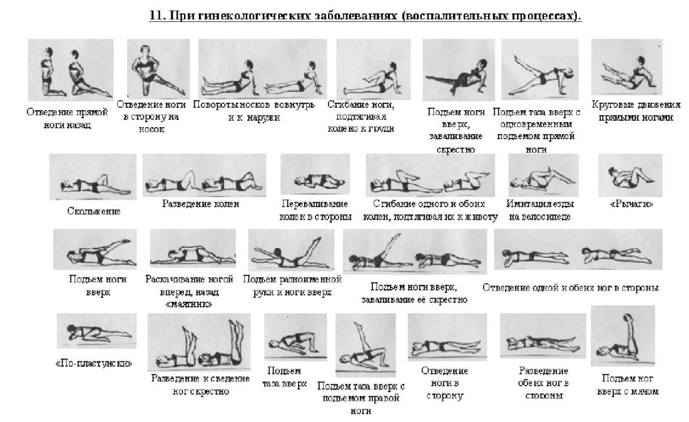 Комплекс упражнений Амосова 1000