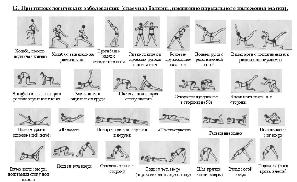 Гимнастика Амосова 1000 движений