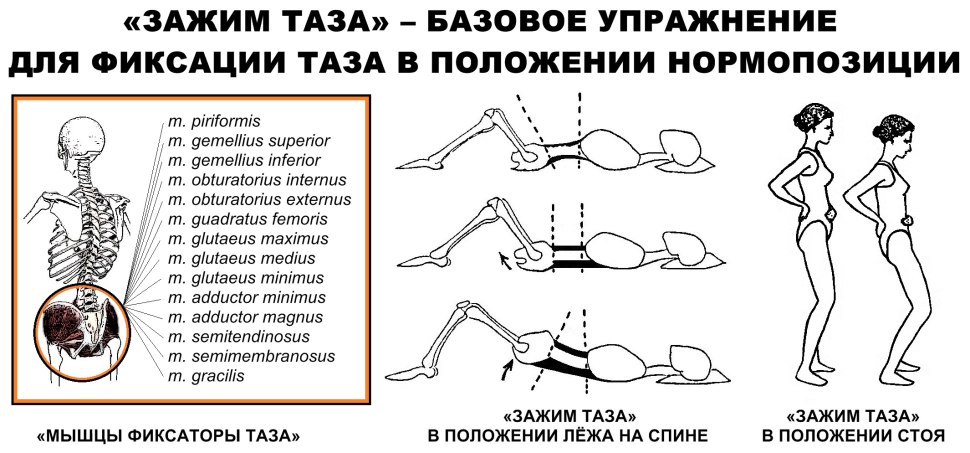 Упражнения для правильного положения таза